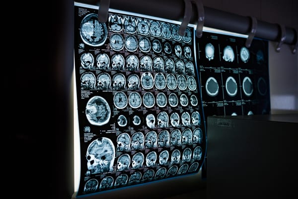 Radiology Associates of Richmond Confirms Data Breach Affecting 1.4 Million Patients