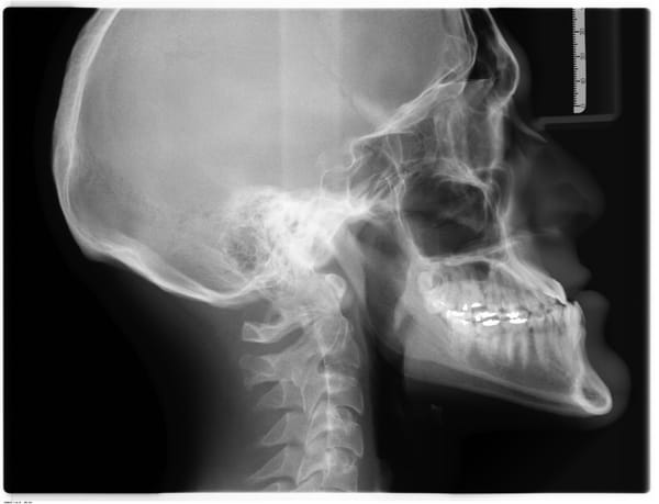 Florida X-Ray Clinic Takes a Year to Tell Patients that Hackers Stole their Medical Data